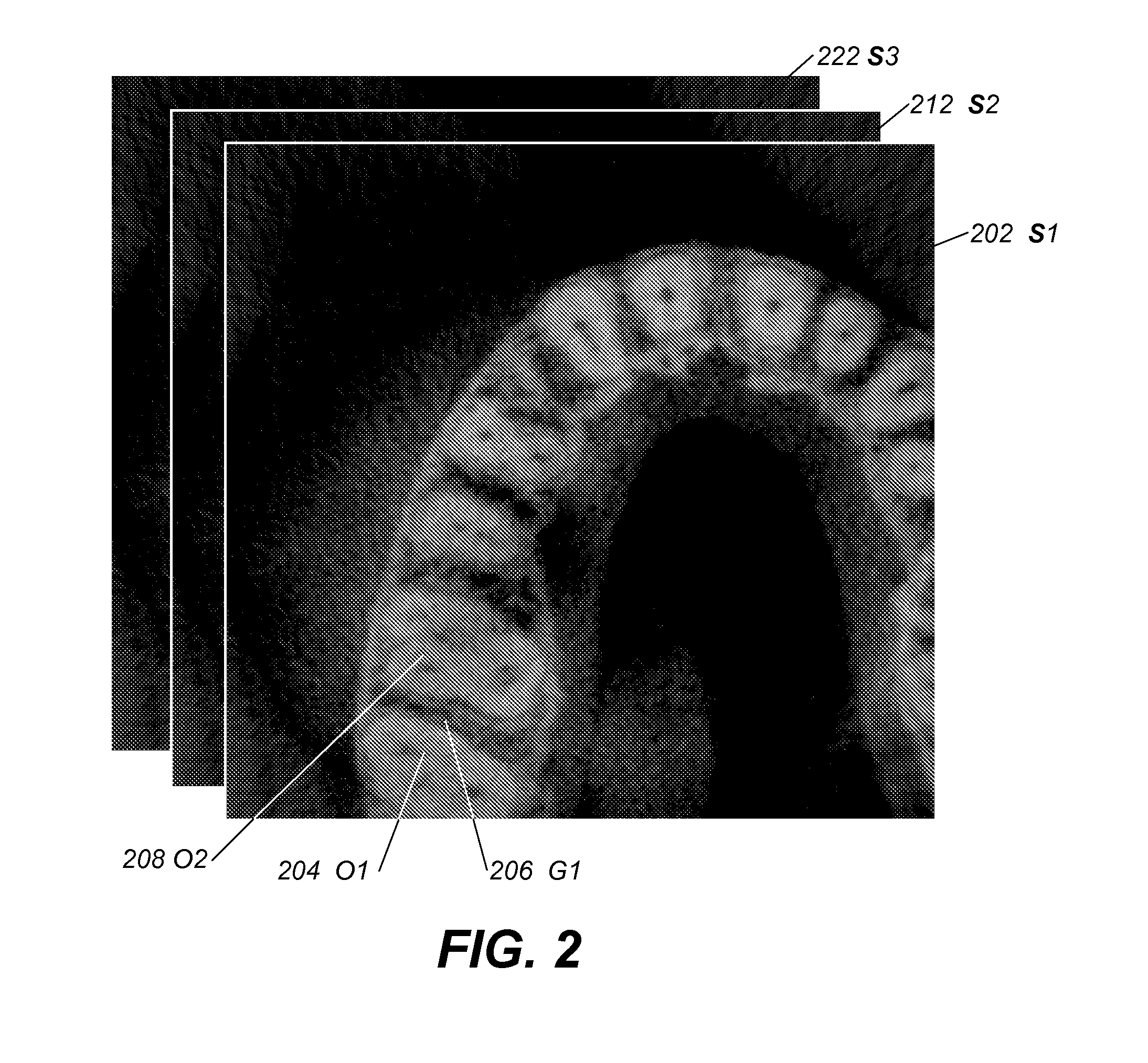 Method and system for tooth segmentation in dental images