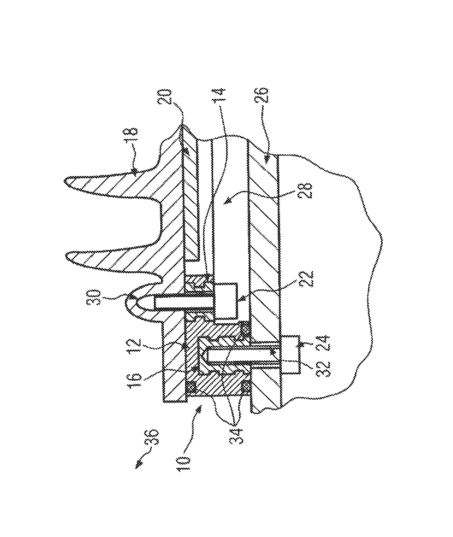 Connection device for connecting an electronic component to a housing part and electronic controller