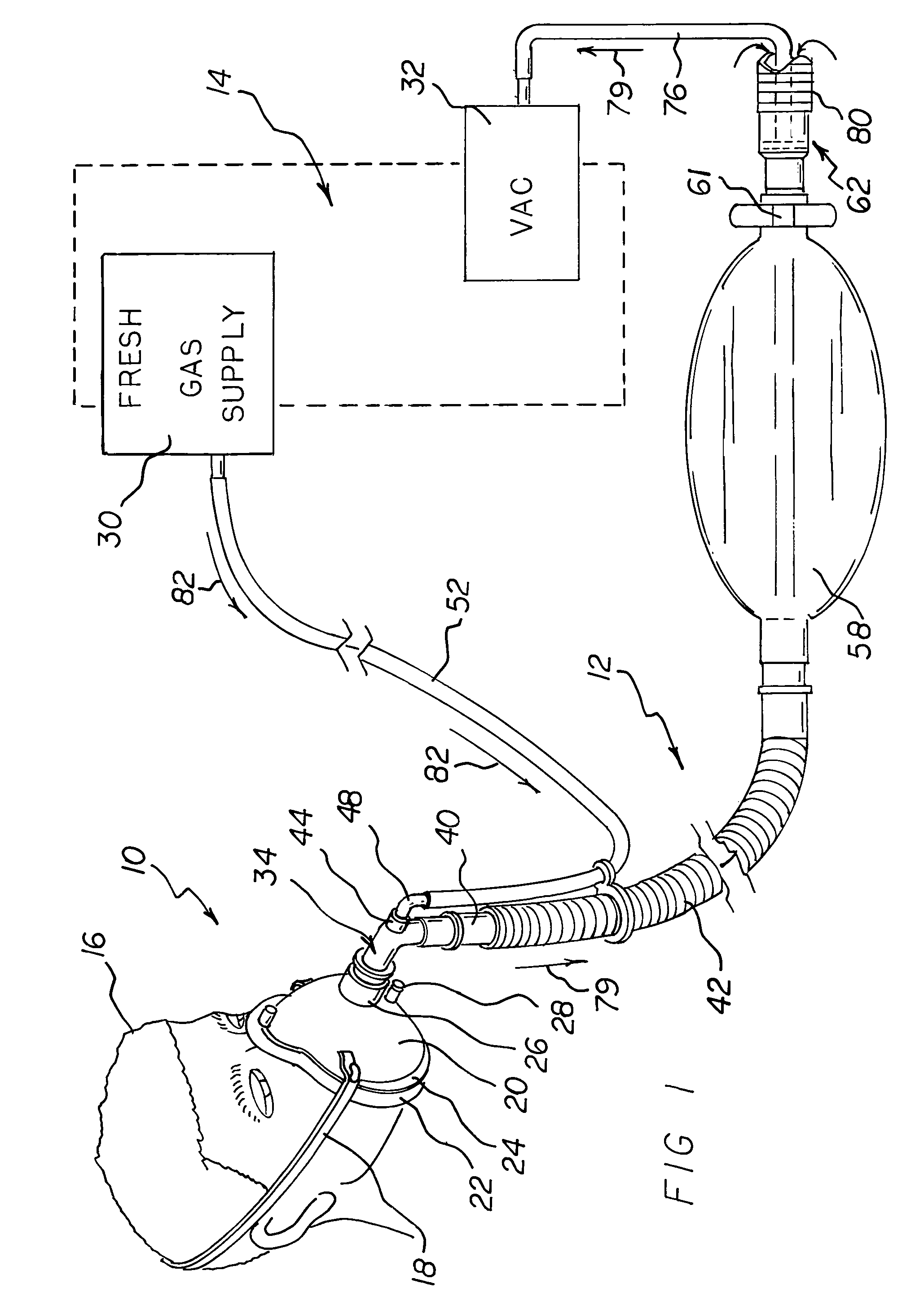 Respiratory face mask and breathing circuit assembly