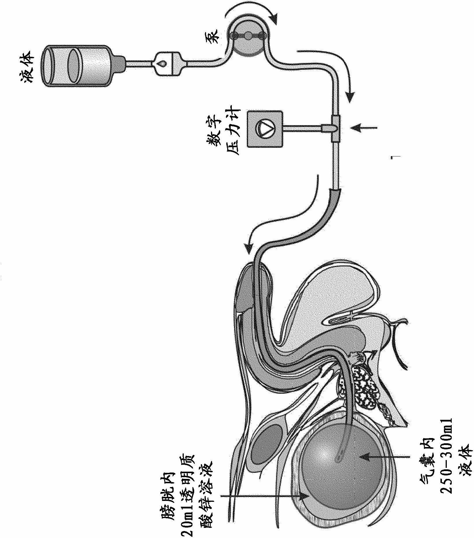 Pharmaceutical composition for the treatment of bladder disorders