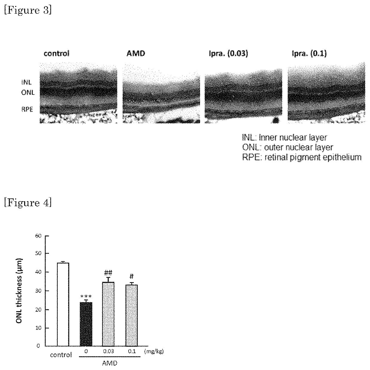 Agent for treating retinal disease