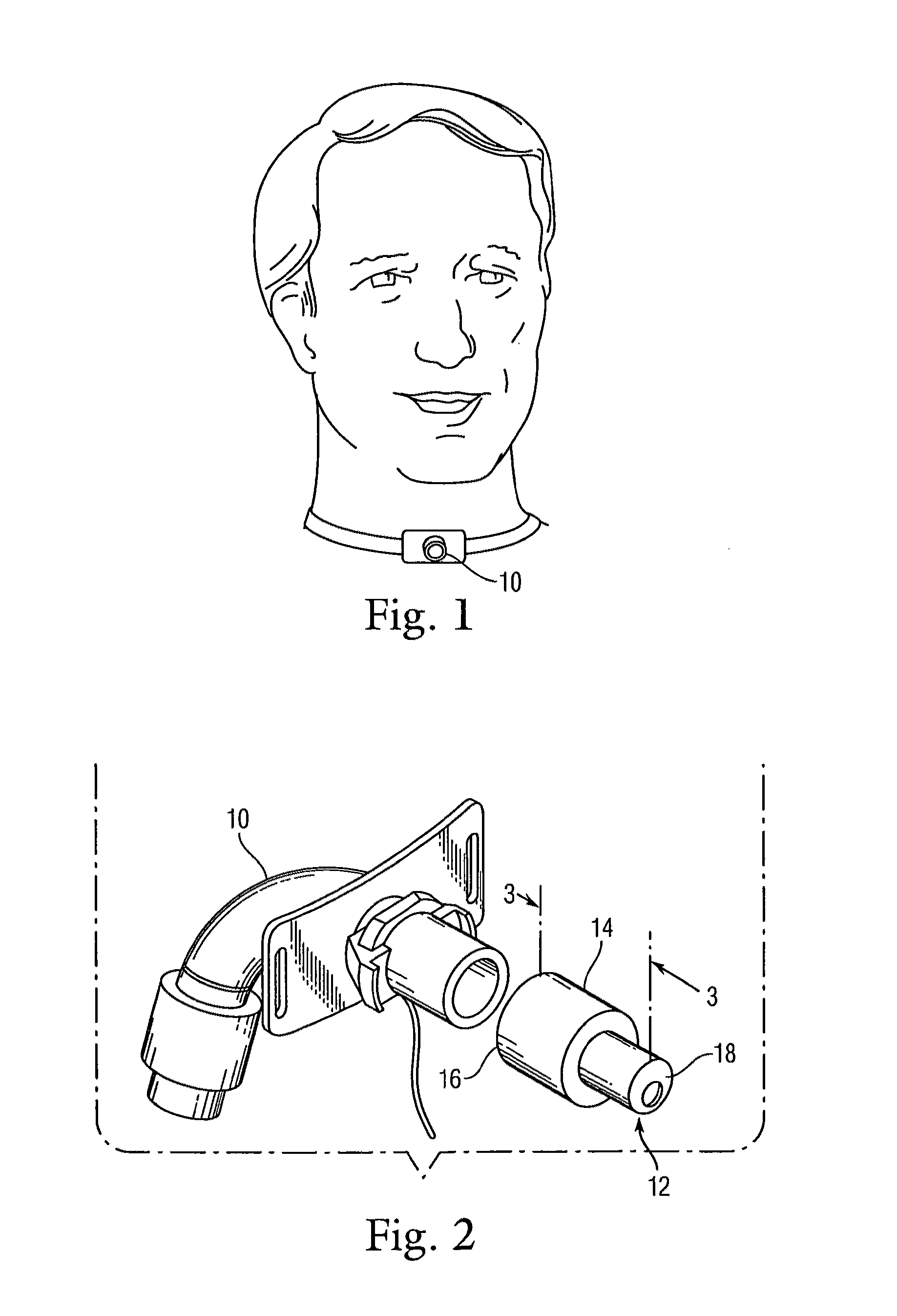 Low profile heat and moisture exchanger device for tracheotomy and speaking valve