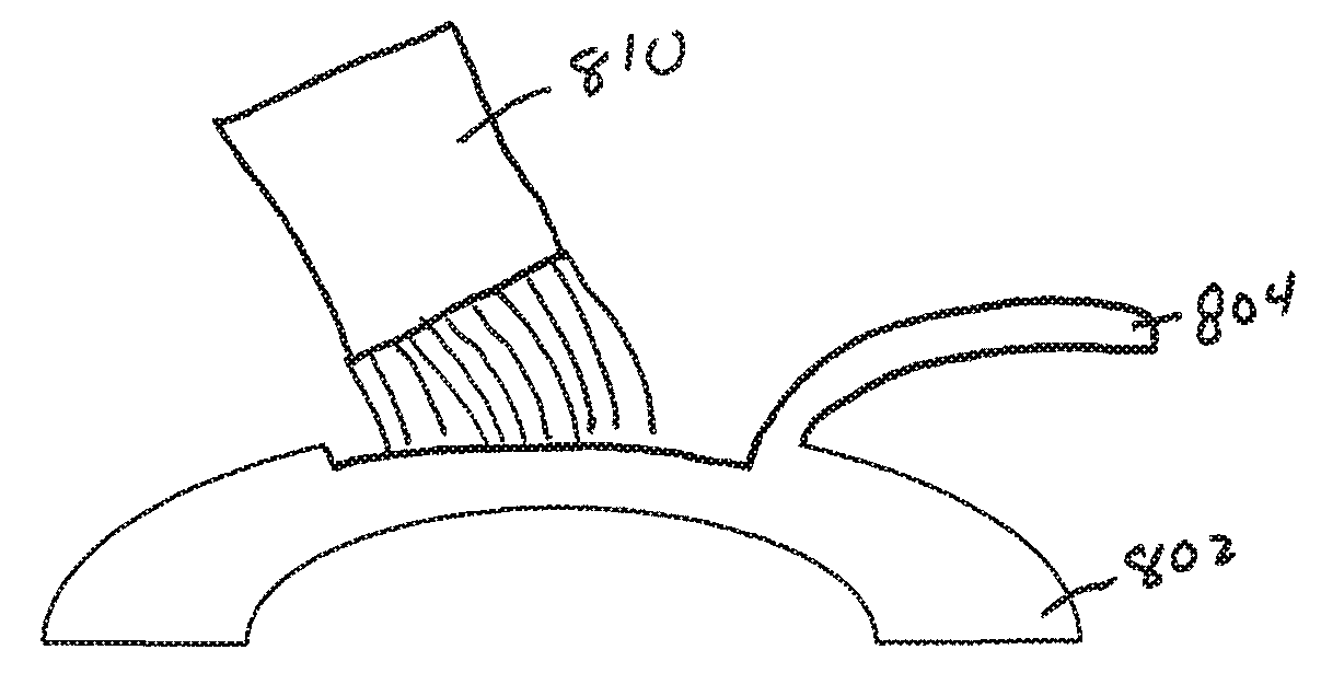 Method of altering the refractive properties of an eye