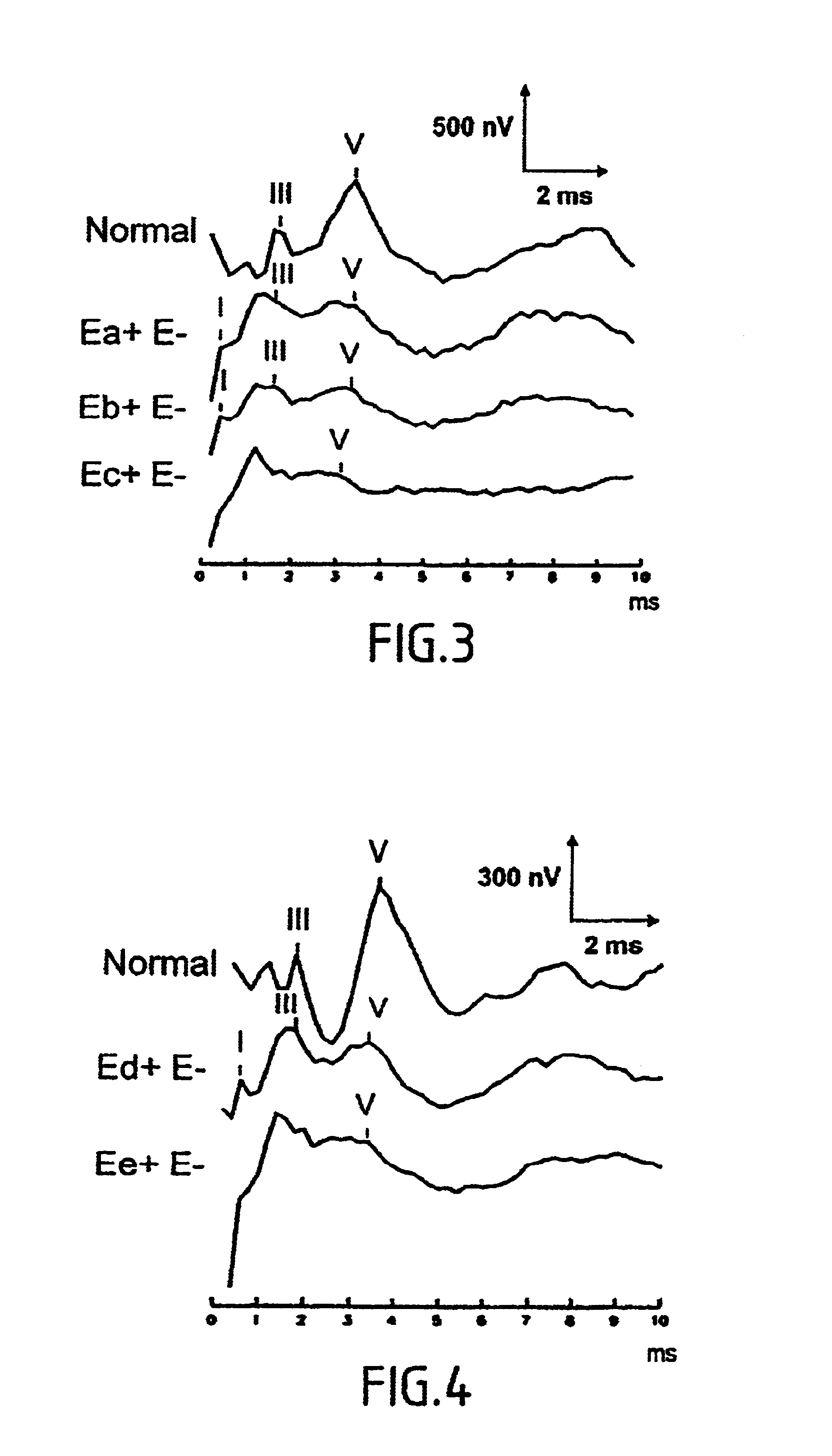 Method and apparatus for picking up auditory evoked potentials