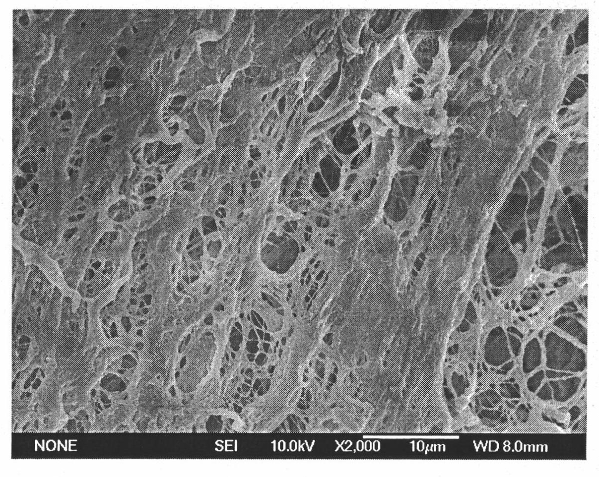 Bio-derived material with high tissue compatibility and long acting anti-infection as well as preparation method and application thereof