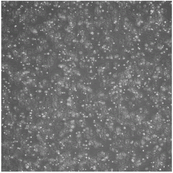 Method for preparing mesenchymal stem cell