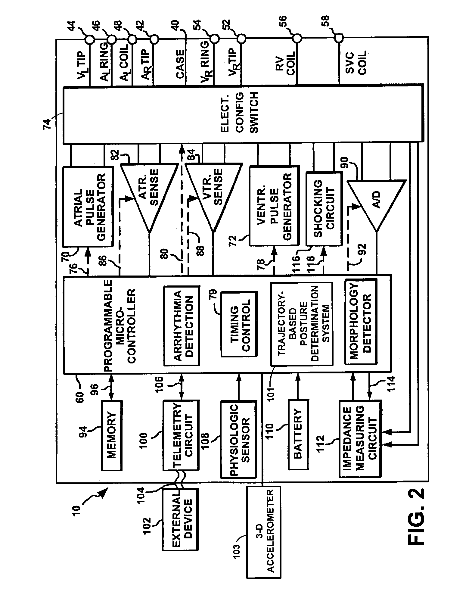 System and method for determining patient posture based on 3-D trajectory using an implantable medical device