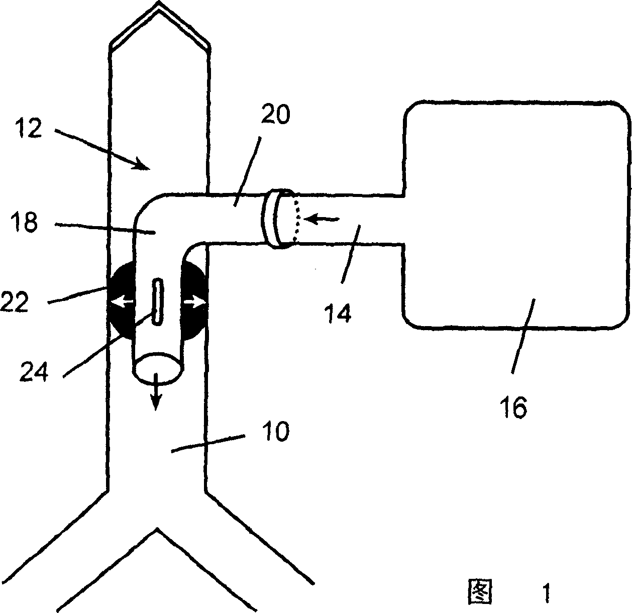 Tracheostomy tube