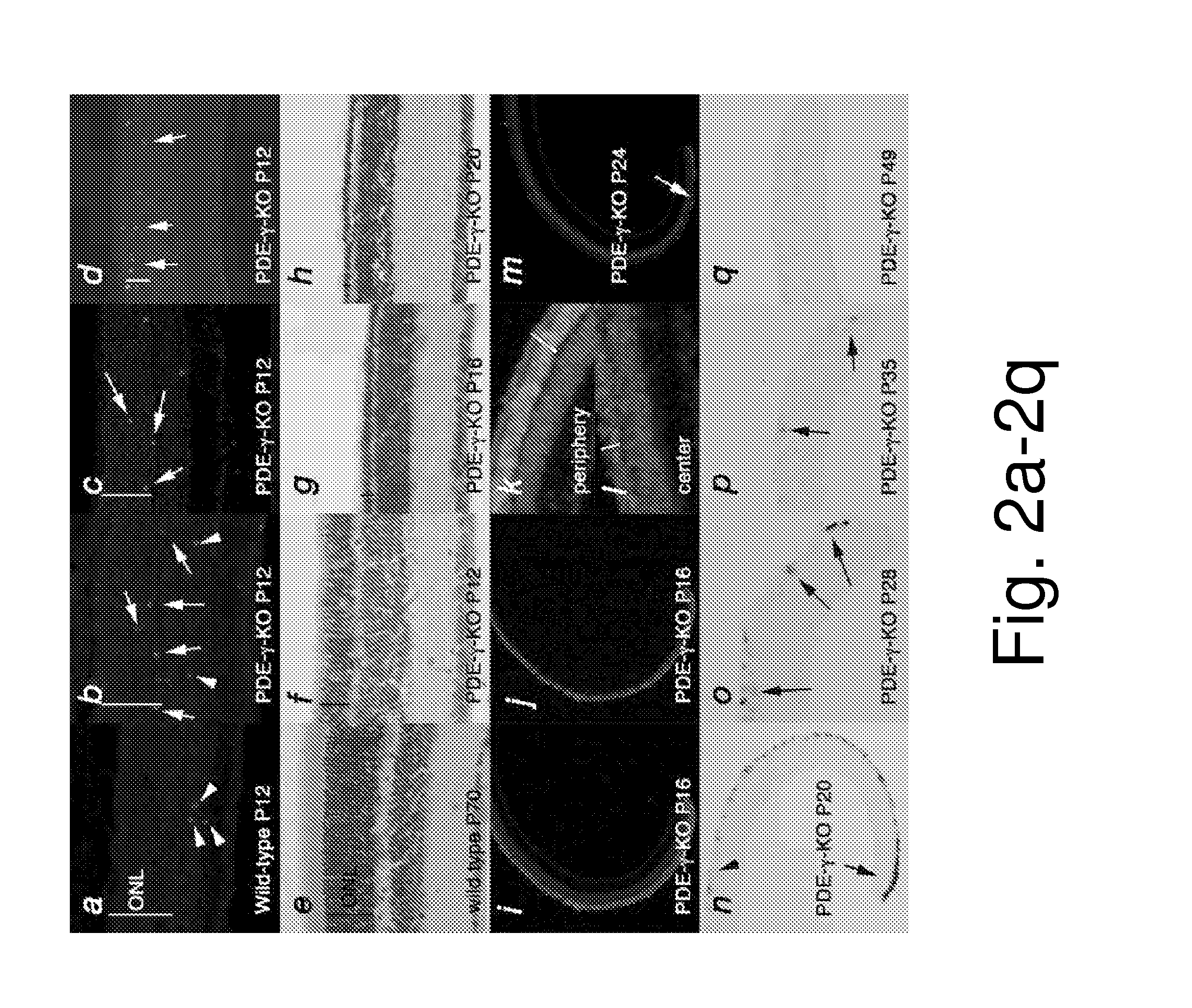 METHODS FOR PROLONGING VIABILITY OF CONE CELLS USING MODULATORS OF THE MAMMALIAN TARGET OF RAPAMYCINE (mTOR)