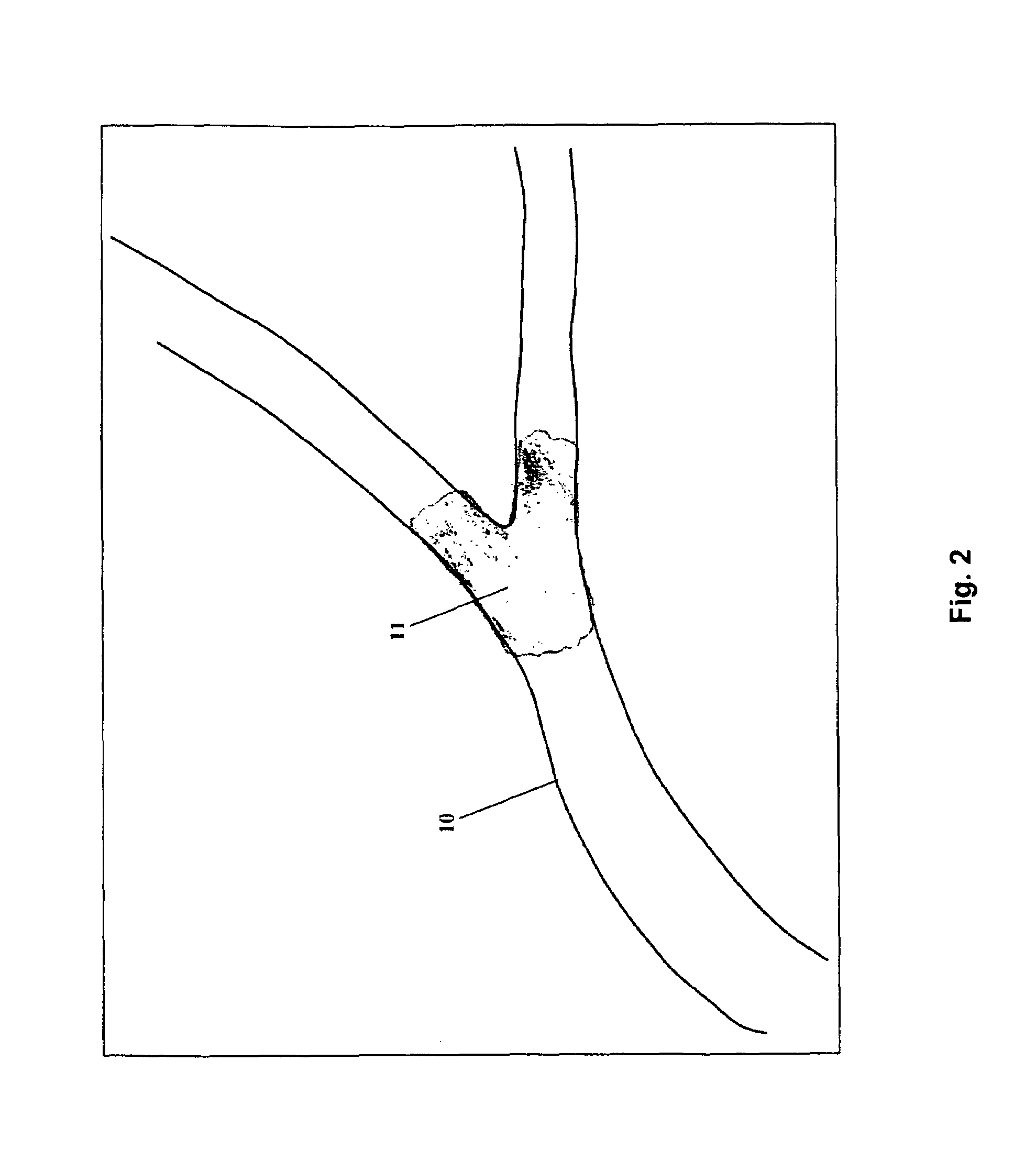 Diagnosis of blood clots using fibrin-binding proteins bound with contrast agents