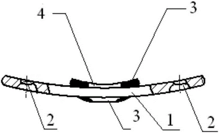 Atlantoaxial dislocation anterior anatomy template with automatic reduction function