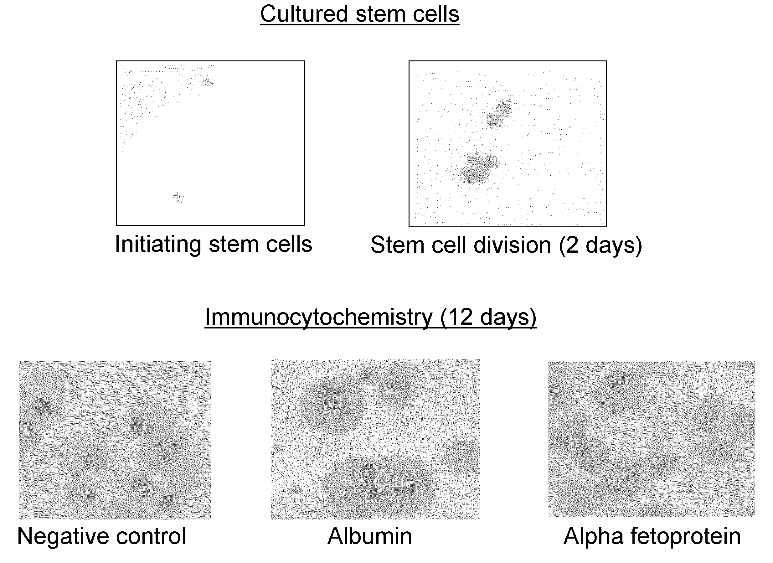 Stem cells