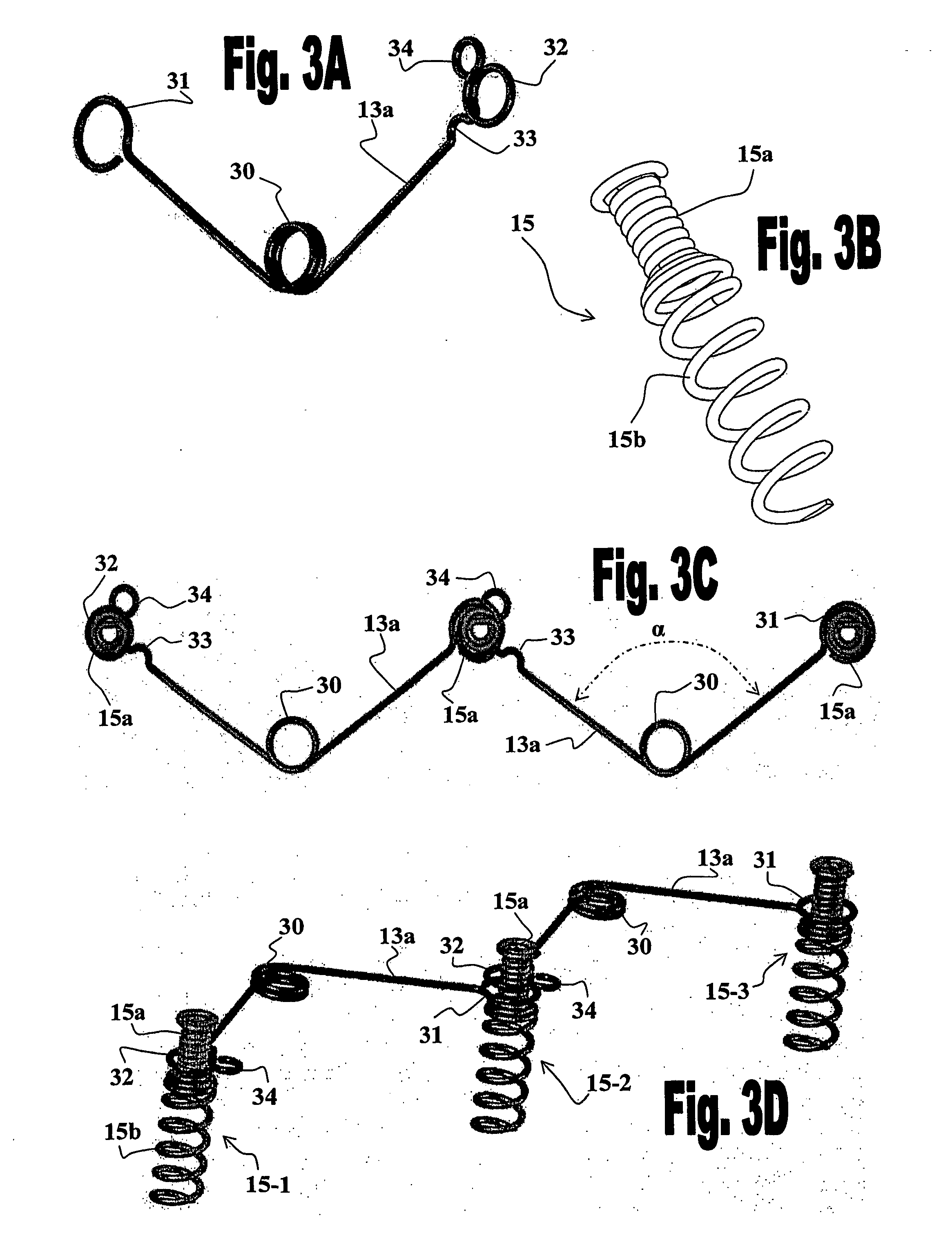 Method and system for improving diastolic function of the heart