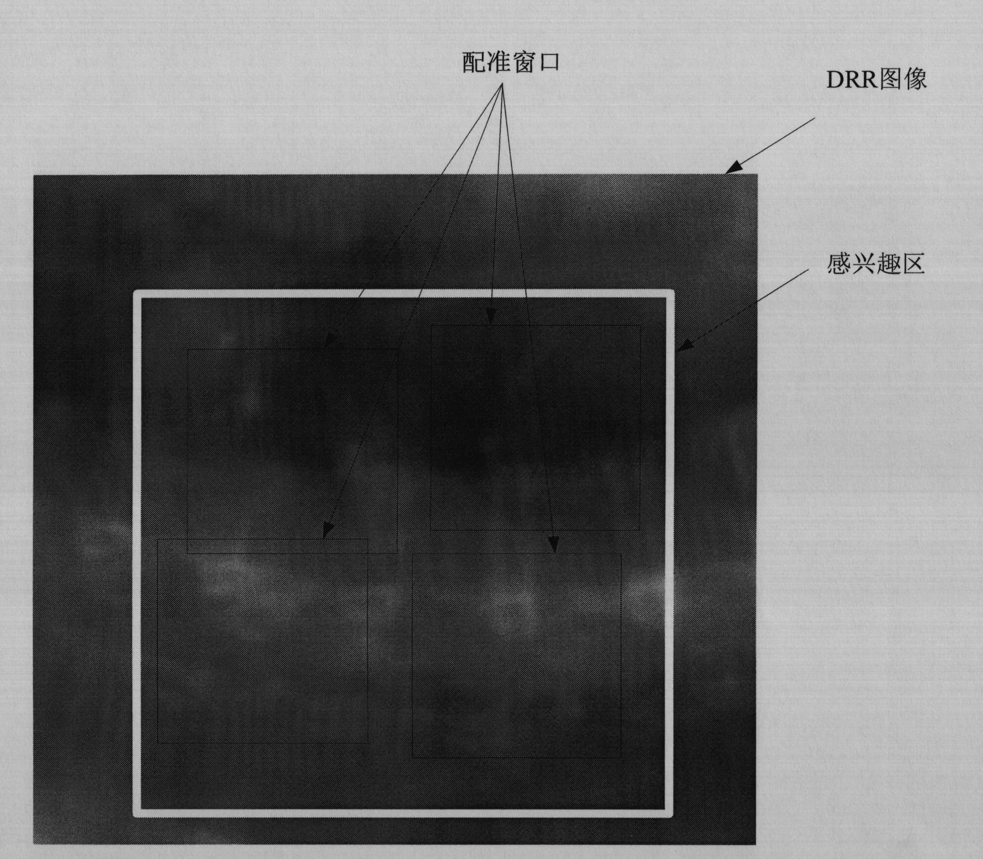 Two-dimensional and three-dimensional medical image registration method and system