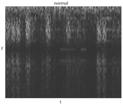 Electroencephalogram classification method based on attention mechanism and convolutional neural network