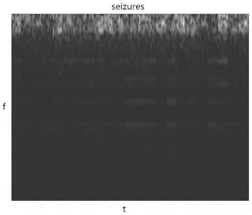 Electroencephalogram classification method based on attention mechanism and convolutional neural network