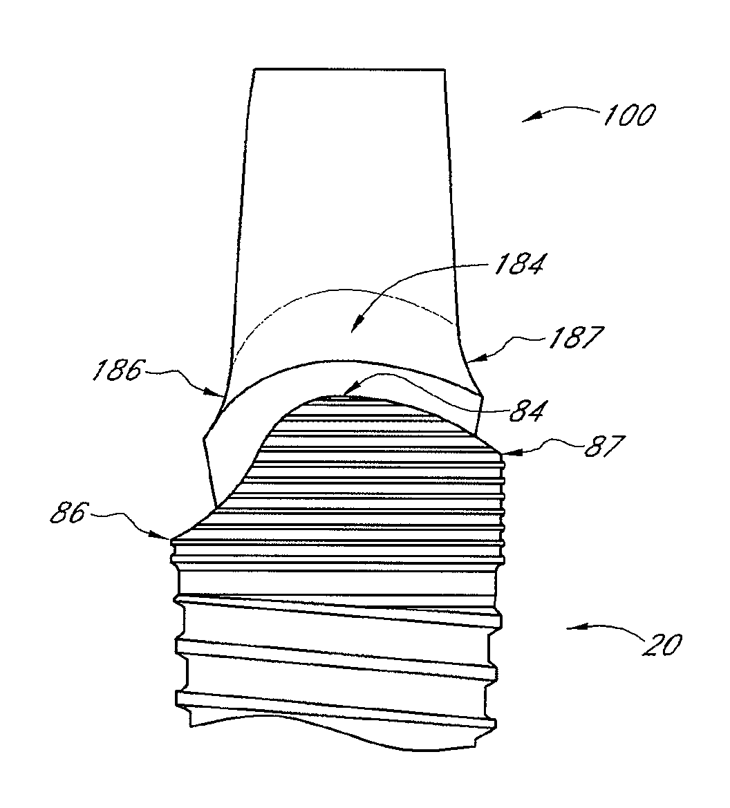 Asymmetrical dental implant