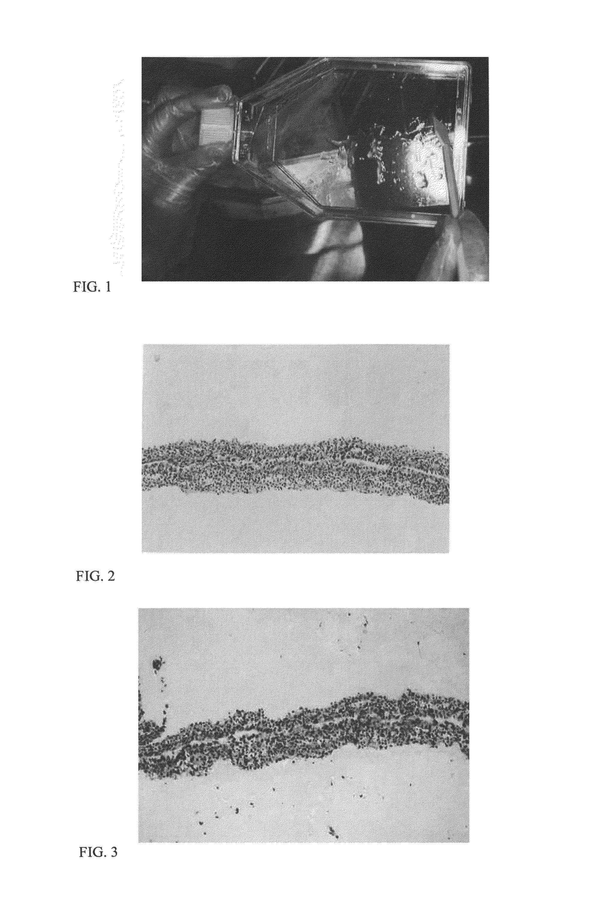 Process for producing cartilage cells for transplantation