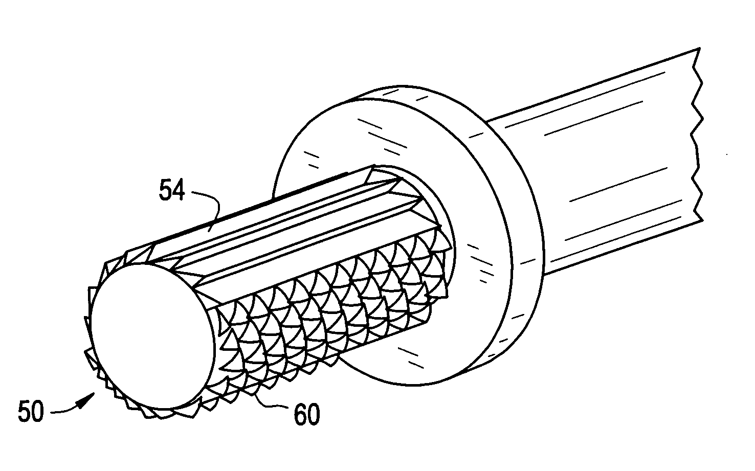 Bone removal tool