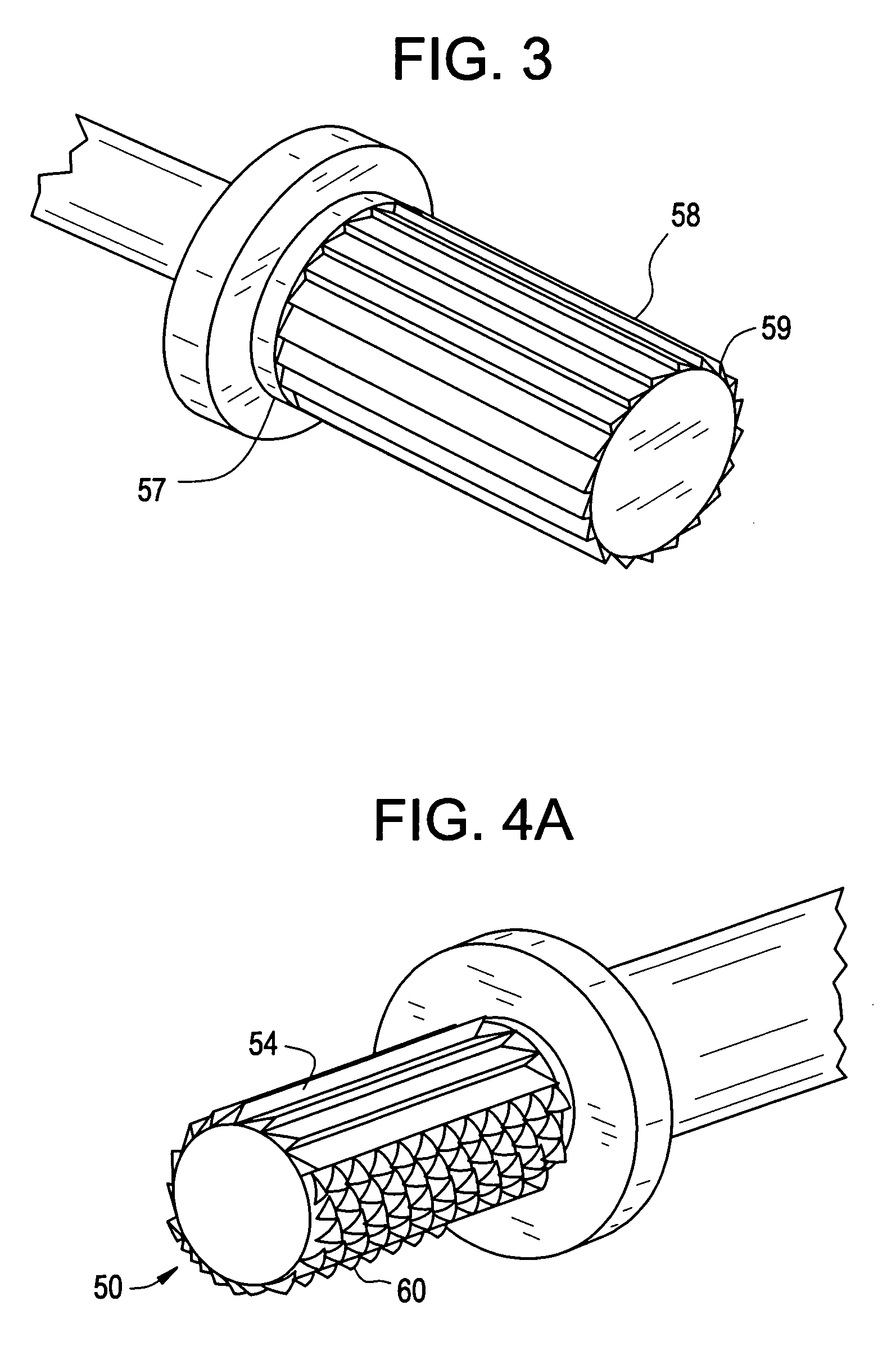 Bone removal tool