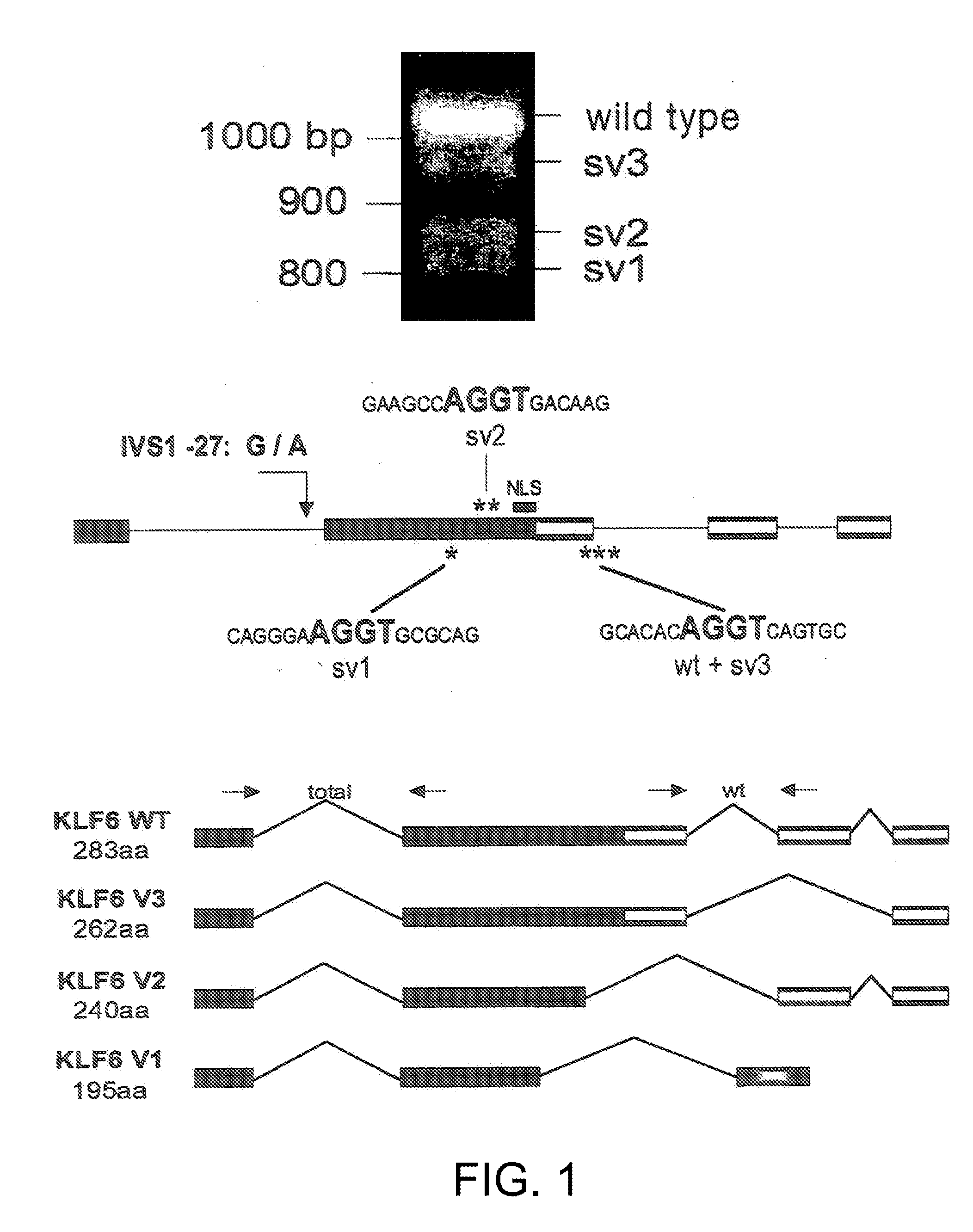 Klf6 alternative splice forms and a germline klf6 DNA polymorphism associated with increased cancer risk