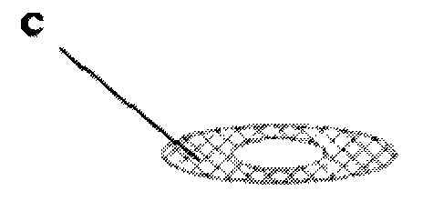 Catalyst loading component and loading method thereof