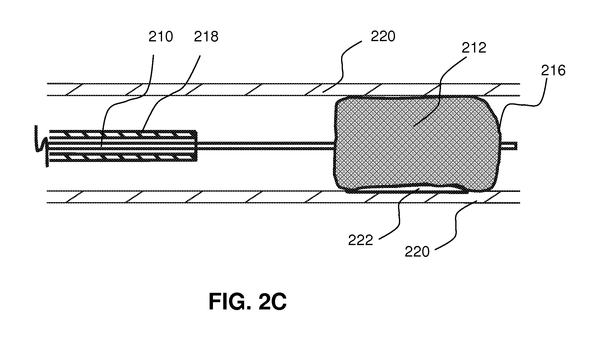 Local delivery of water-soluble or water-insoluble therapeutic agents to the surface of body lumens