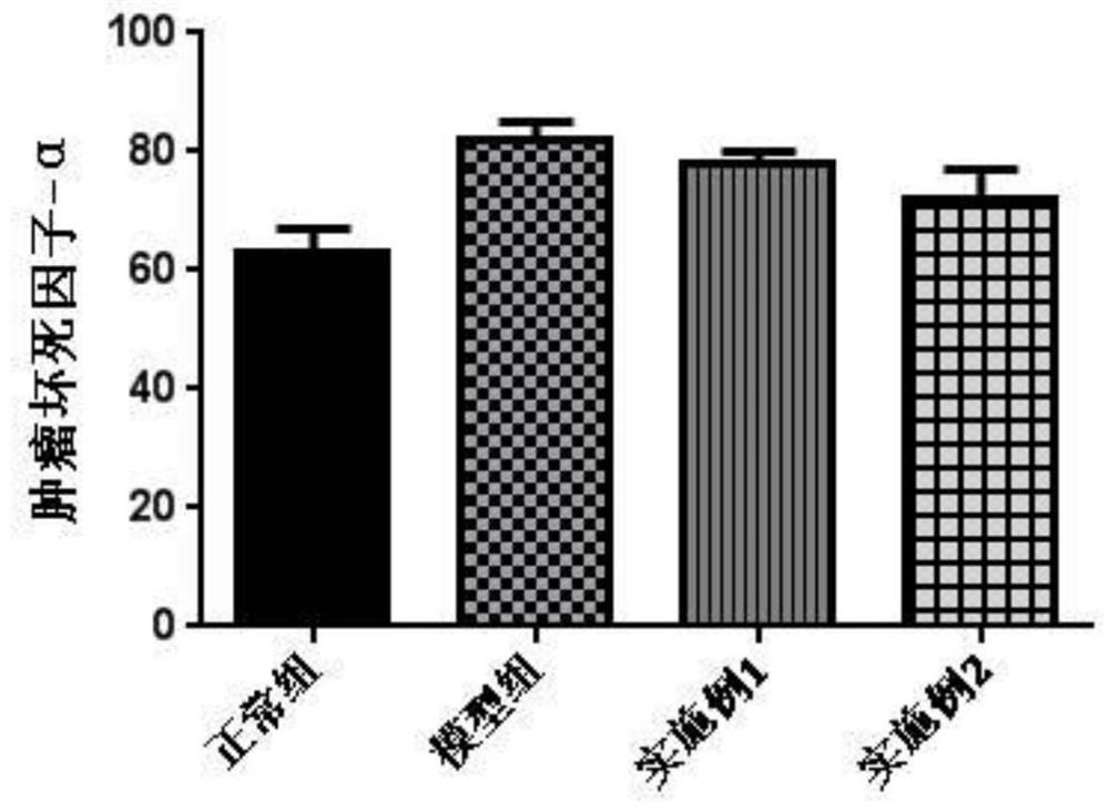 Sunflower disc extract, medicine containing sunflower disc extract, preparation method and application of medicine