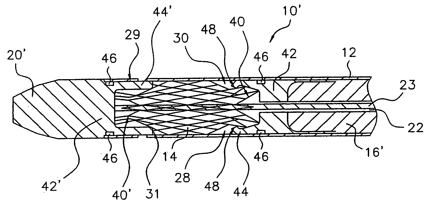 Delivery system for endoluminal implant