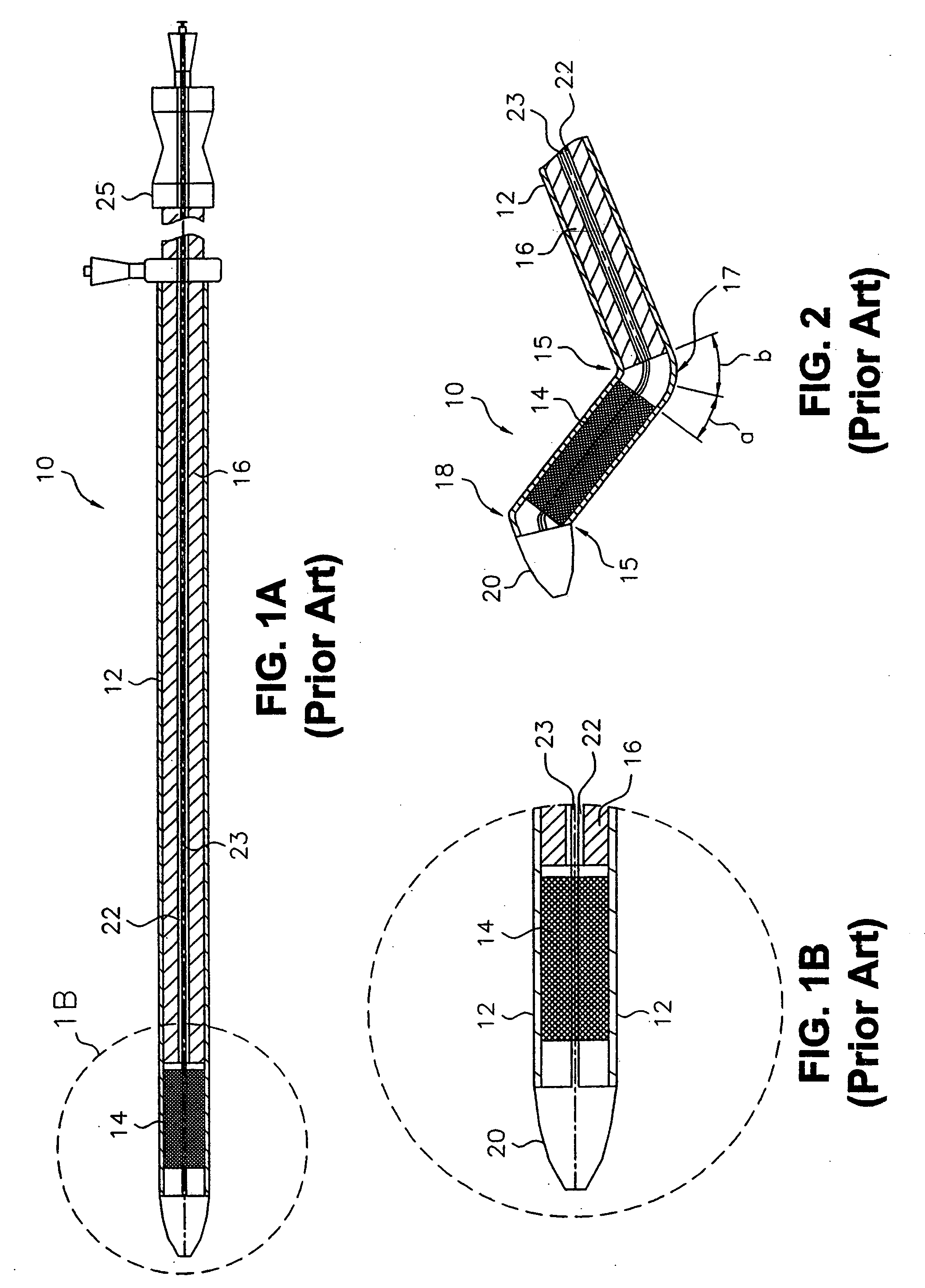 Delivery system for endoluminal implant