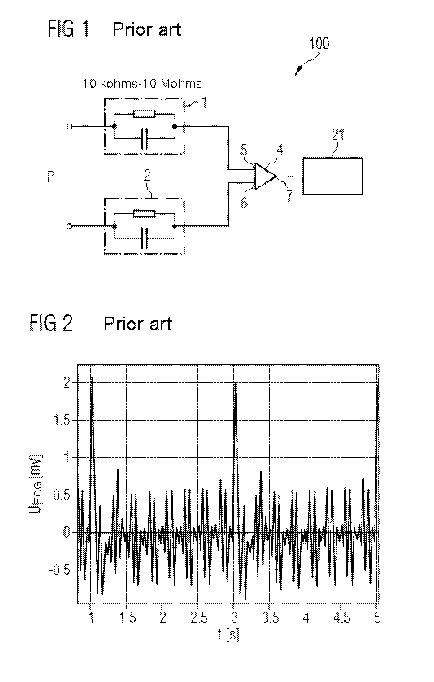 Rejection of the common-mode signal component in the measurement of bioelectric signals