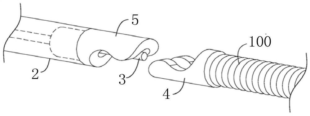 Post-release device for medical instrument implant