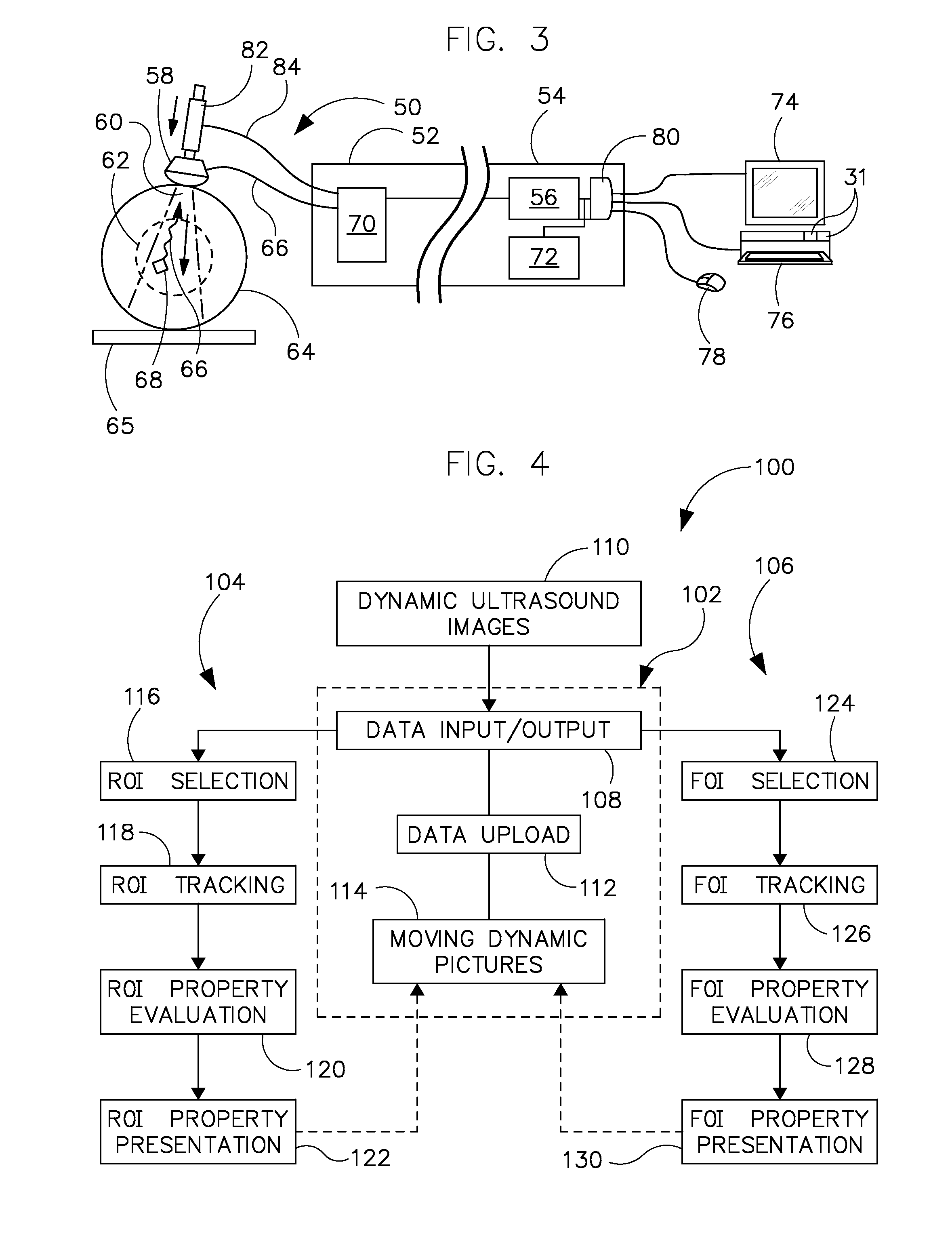 System and method of ultrasound image processing