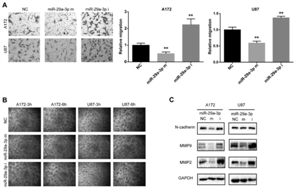 Application of microRNA-29a-3p as a target for the prevention and treatment of vascular mimicry in glioma