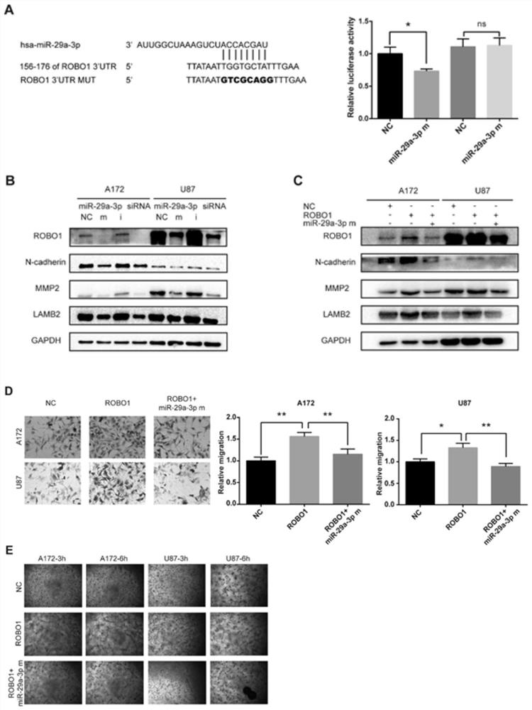 Application of microRNA-29a-3p as a target for the prevention and treatment of vascular mimicry in glioma