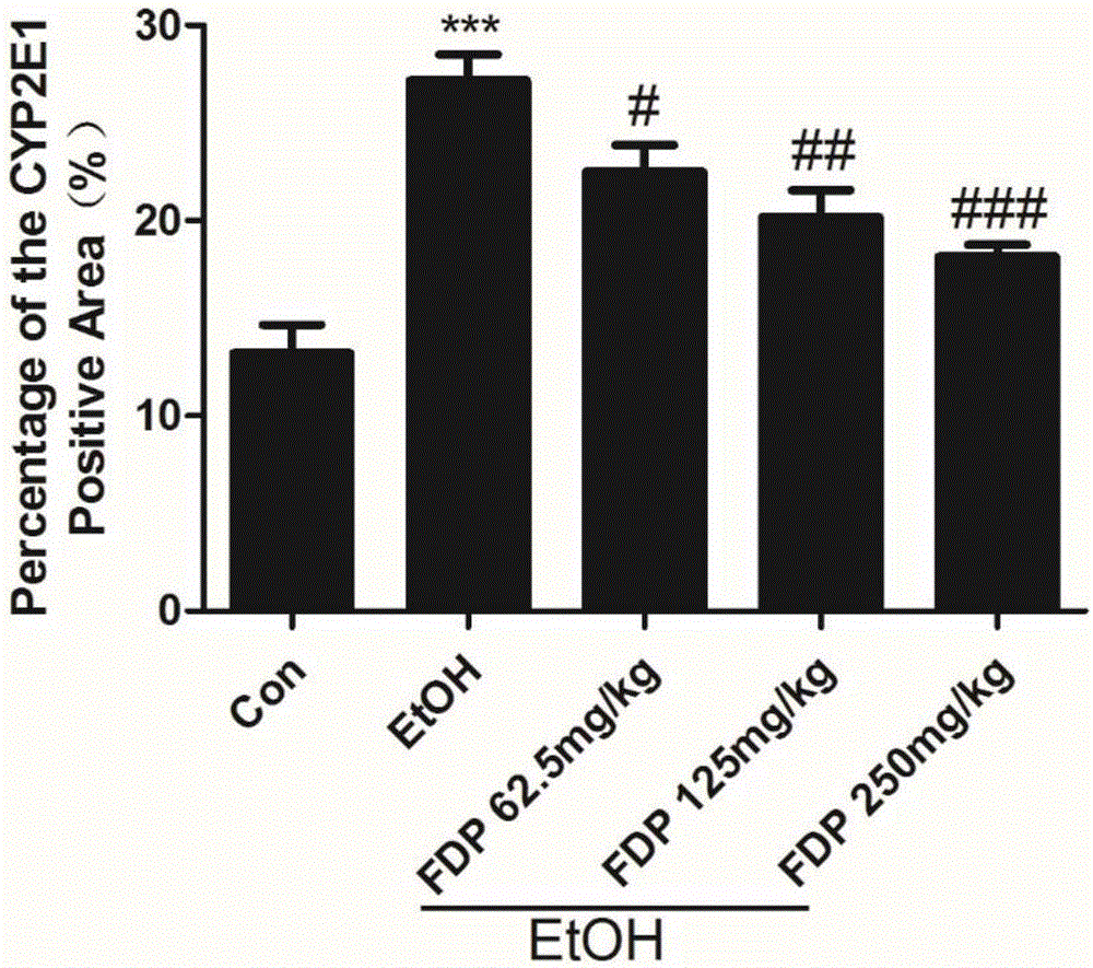 Application of 1,6-fructose diphosphate in preparing medicine for treating alcoholic liver damage