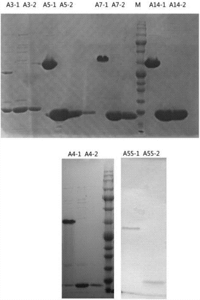 Recombinant expression adenovirus cilia protein peptide, adenovirus subunit vaccine and preparation method of recombinant expression adenovirus cilia protein peptide