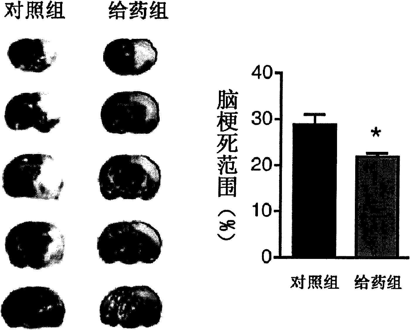 Application of nicotinamide mononucleotide