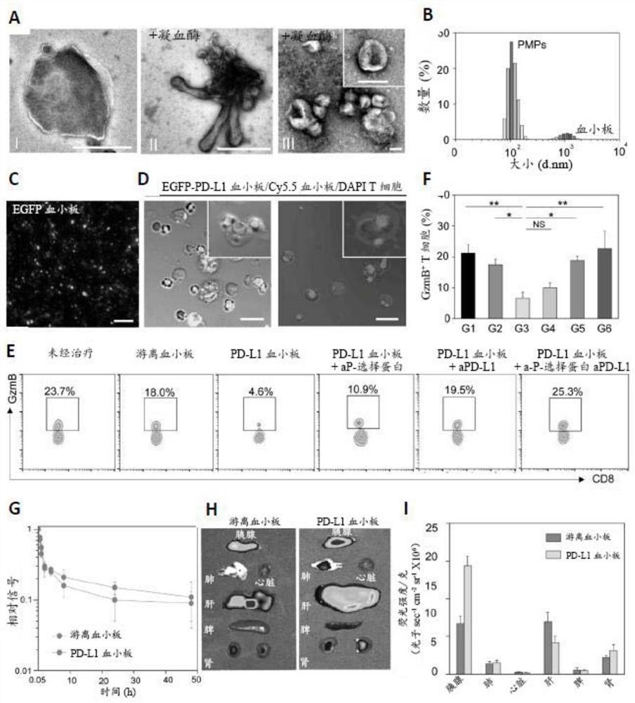 PD-L1 presenting platelets reverse new-onset type 1 diabetes