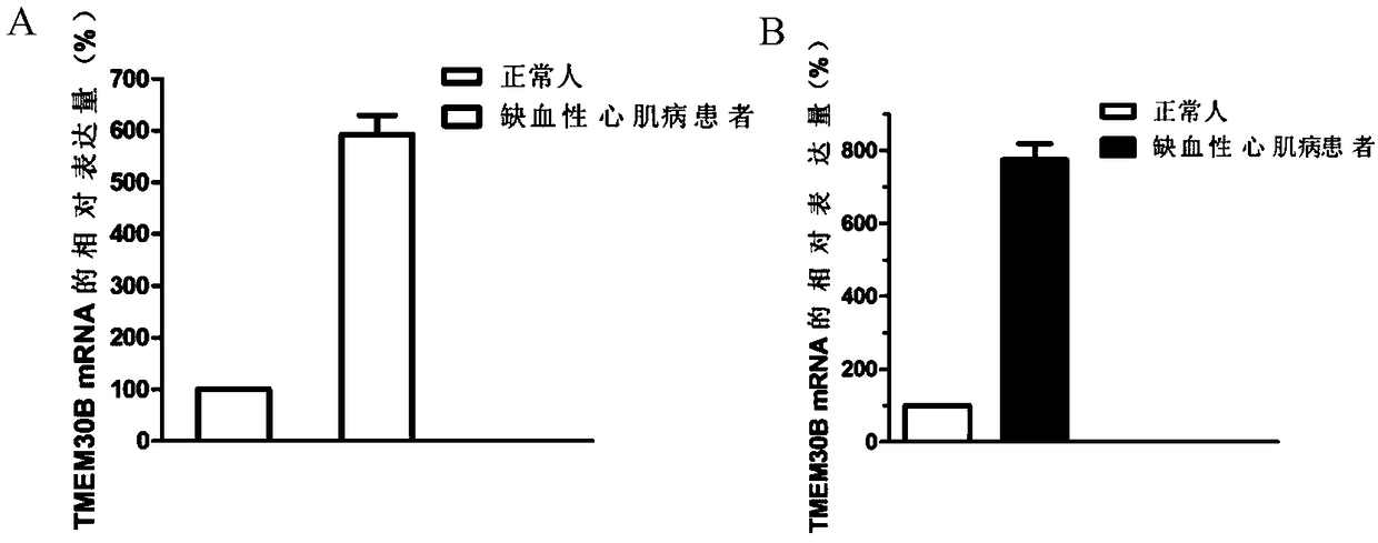 Application of gene marker in diagnosing ischemic cardiomyopathy