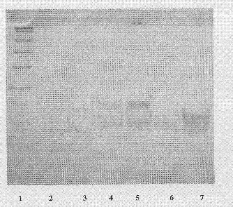 Hypha mycin gene and karyogamy gene-engineering bacteria thereof