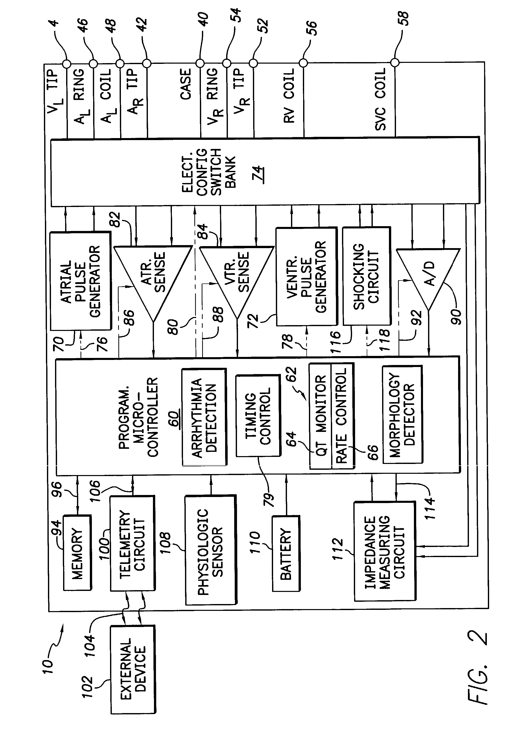 System and method for treating abnormal ventricular activation-recovery time