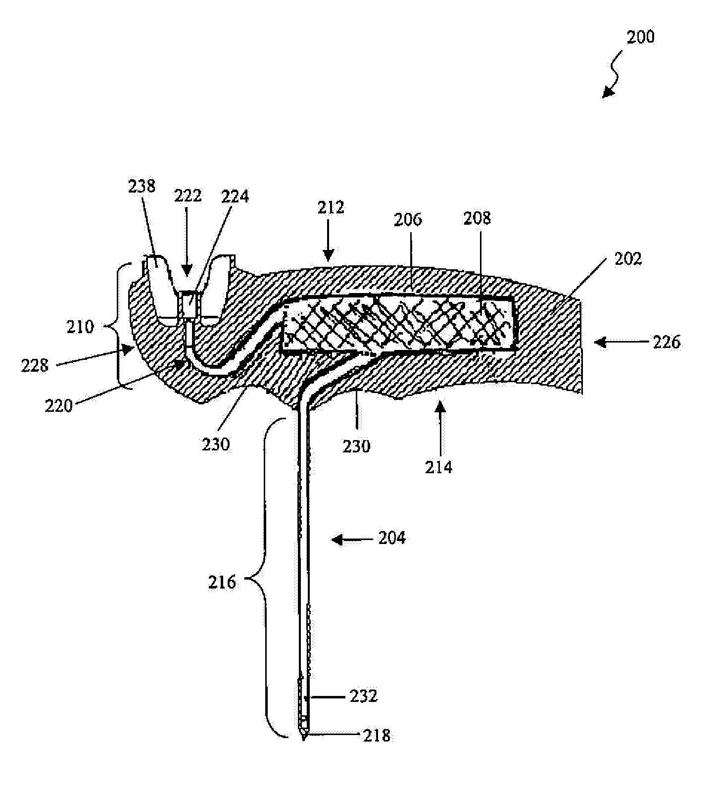 Bone marrow aspiration system