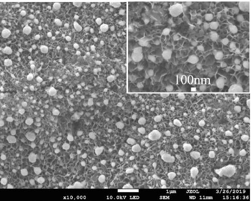 Artificial tooth root with synergistic antibacterial coating and preparation method of artificial tooth root