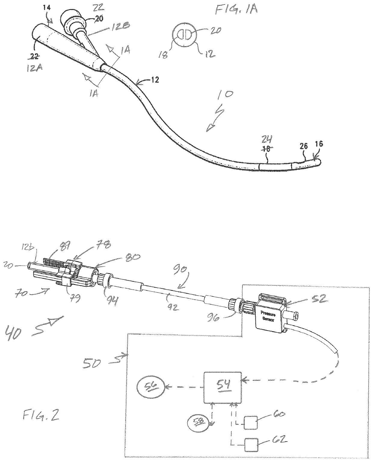 Bladder storage anomaly assessment