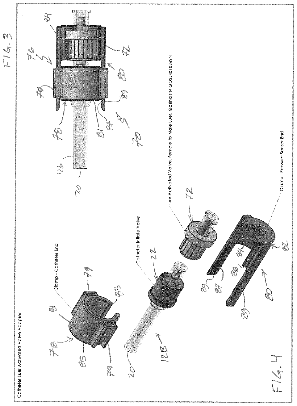 Bladder storage anomaly assessment