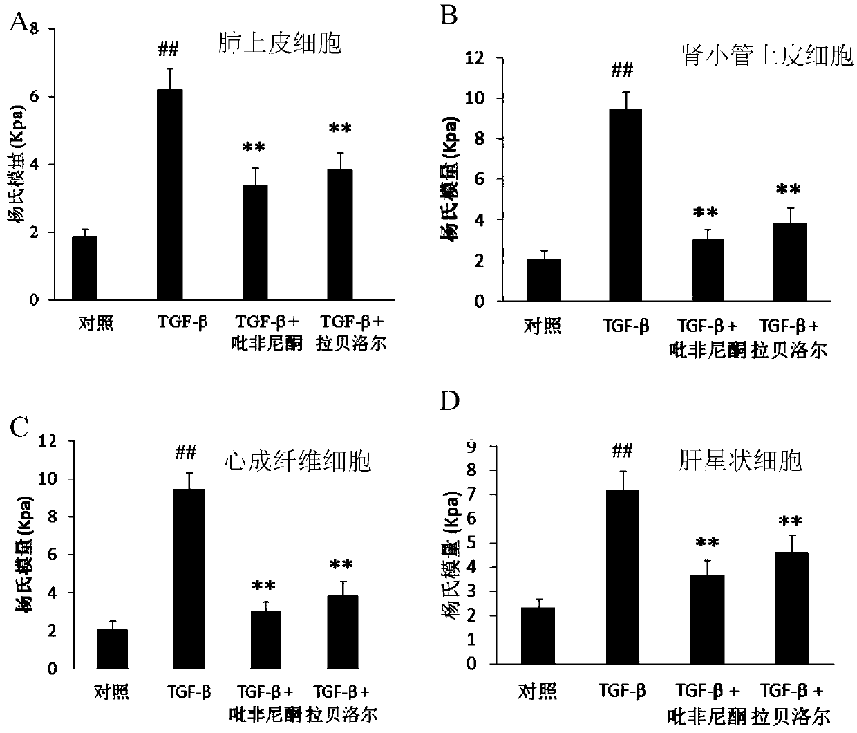 Application of labetalol in preparation of medicine for preventing and treating fibrotic diseases