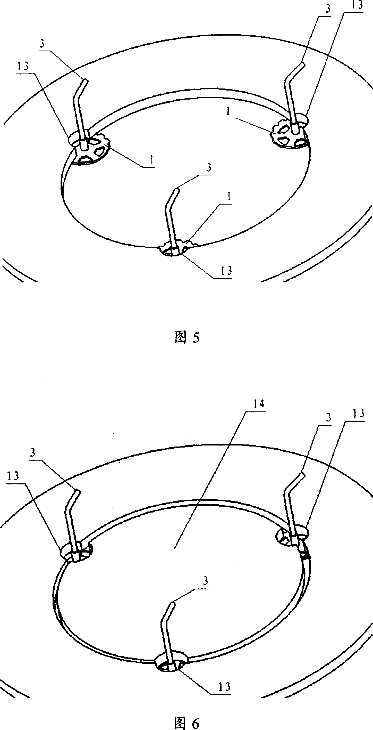 Withdrawable fixing device for postoperative skull and other osseous tissue