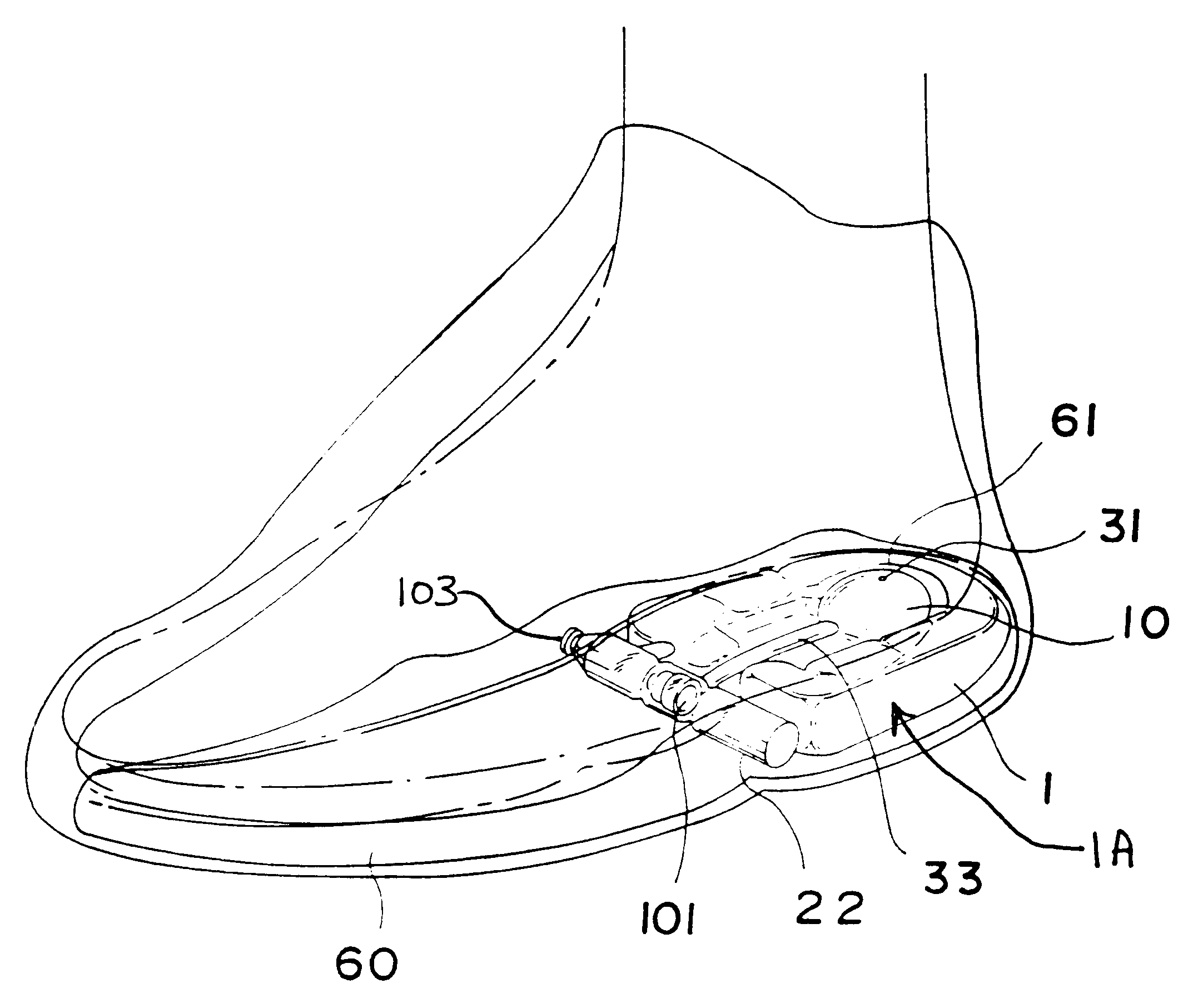 Self-inflatable air cushion for shoes