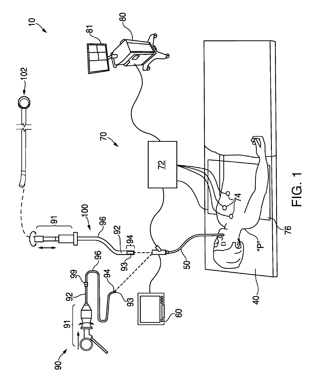 Assessment of suture or staple line integrity and localization of potential tissue defects along the suture or staple line